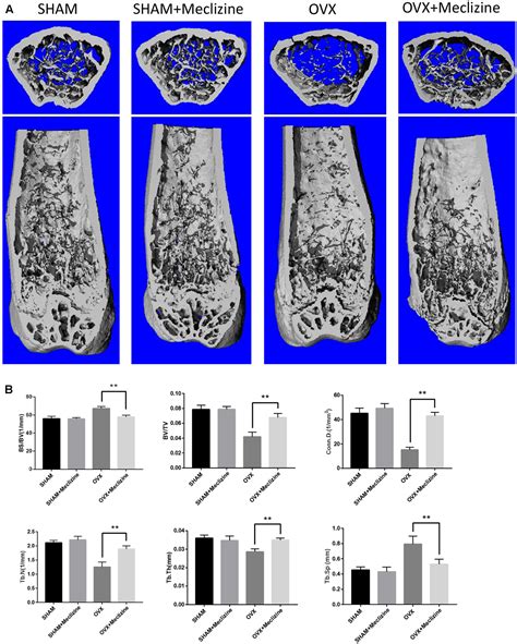 Frontiers Meclizine Prevents Ovariectomy Induced Bone Loss And