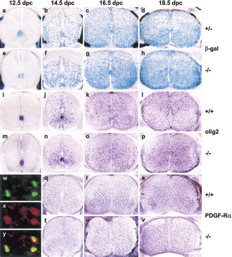 Sox10 Expression And Development Of Oligodendrocyte Progenitors In The