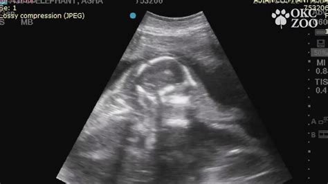 Zoo Shares An Ultrasound Of A Baby Elephant And People Find It Adorable ...