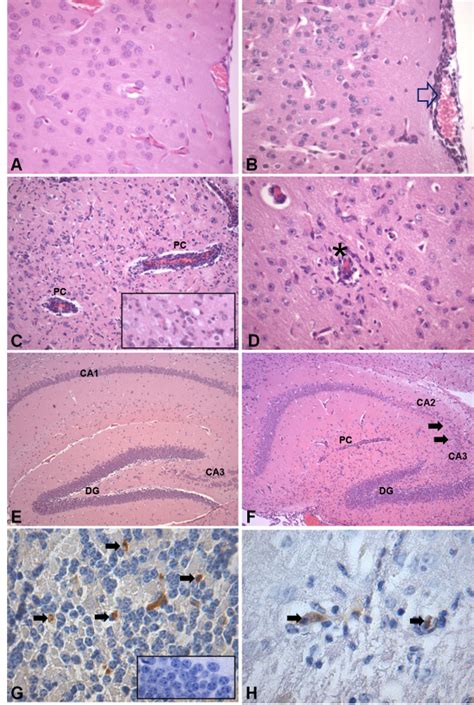 Histopathological changes in brain of control mice (n = 4) and of mice ... 