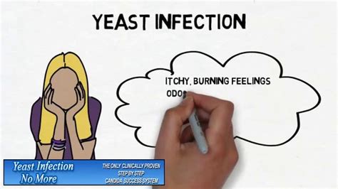 How To Know You Have A Yeast Infection 🚑 How Do You Know If You Have Ye Yeast Infection