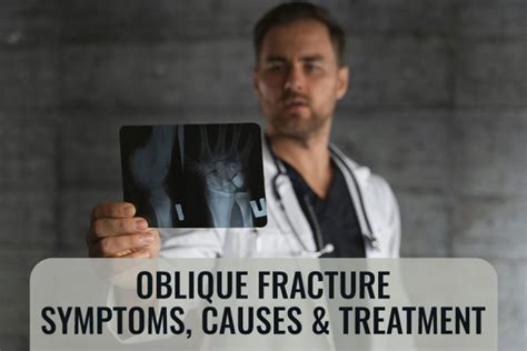 Oblique Fracture: Symptoms, Causes & Treatment | ER of Mesquite