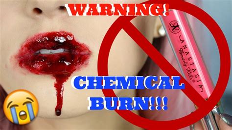 Chemical Burn On Lips From Lipstick | Lipstutorial.org