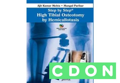 Step By Step High Tibial Osteotomy By Hemicallotasis Mangal Parihar