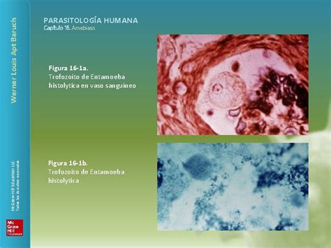 Parasitologa Humana Captulo 16 Amebiasis Werner Louis Apt