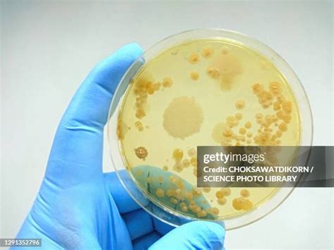 880 Bacterial Culture Test Stock Photos, High-Res Pictures, and Images ...