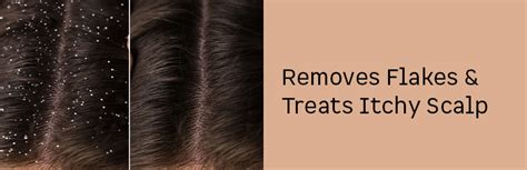 Buy MCaffeine Naked Raw Coffee Scalp Scrub For Dandruff Control Scalp Exfoliation With