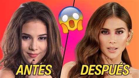 Greeicy Rend N Antes Y Despu S De Qu Se Oper Youtube