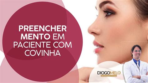 Preencher Mento Em Paciente Covinha YouTube