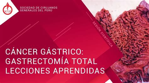 CÁncer GÁstrico GastrectomÍa Total Lecciones Aprendidas Youtube