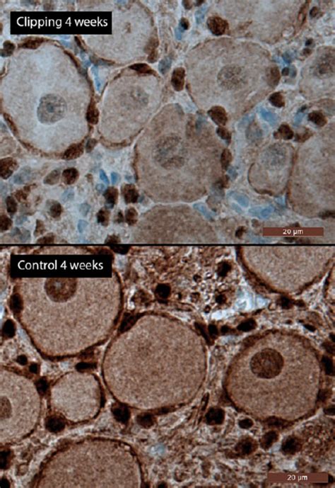 S100 Stains After 4 Weeks Demonstrate Discontinuous Schwann Cell