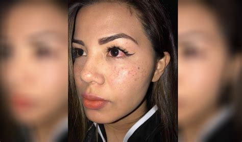 Estrella Torres Denunci Que Fue Agredida