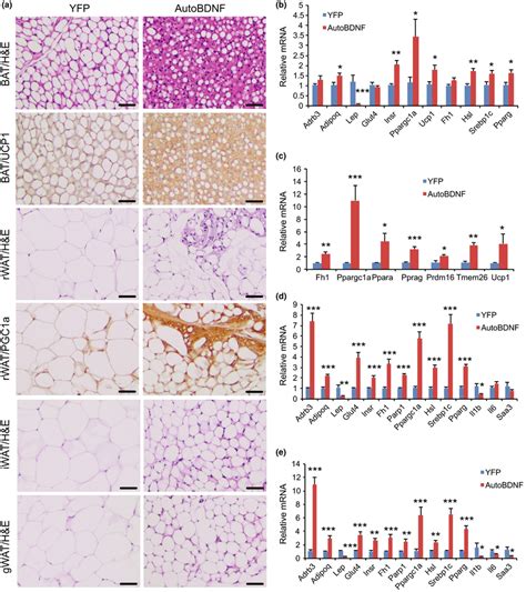 Hypothalamic Gene Transfer Of Bdnf Remodels Adipose Tissues A