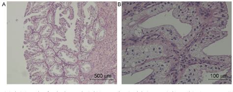 Figure 1 From Escherichia Coli Virulence Influences The Roles Of Sex Hormone Receptors In Female