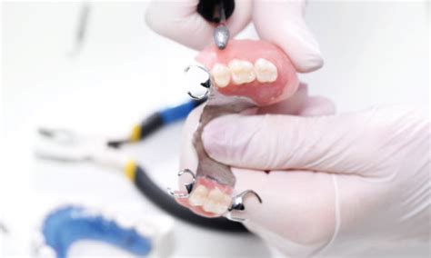 Services Shepparton Denture Clinic