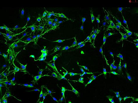 Human Aortic Adventitial Fibroblasts HAAF