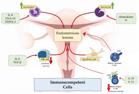 Theories On The Pathogenesis Of Endometriosis Encyclopedia Mdpi