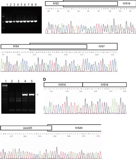 Breakpoint Analysis Of BRCA1 And BRCA2 Large Genomic Rearrangements