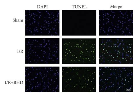 Neuronal Apoptosis Of Rats In Different Groups At 1 3 And 7 D