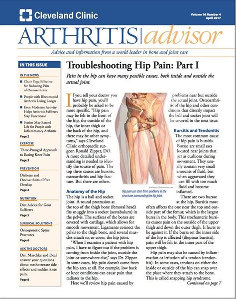 Download The Full April 2017 Issue Pdf Arthritis Advisor