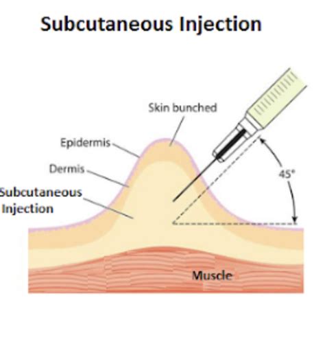 Subcutaneous Injection: Understanding the Basics - TruTanMT2