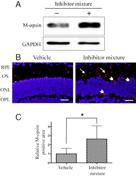 Western Blotting And Immunohistochemistry Analysis Of M Opsin