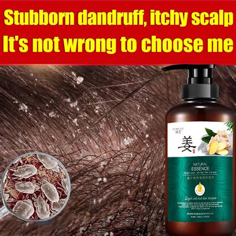 Shampoo Anti Dandruff Refreshing Oil Control Hilangkan Kelemumur Ubat