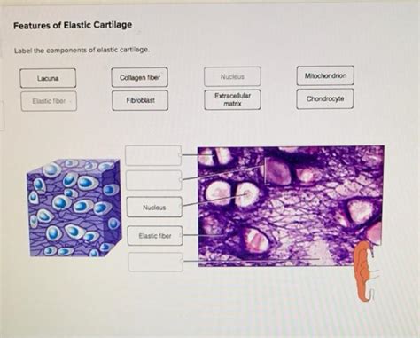 Solved Features of Elastic Cartilage Label the components of | Chegg.com