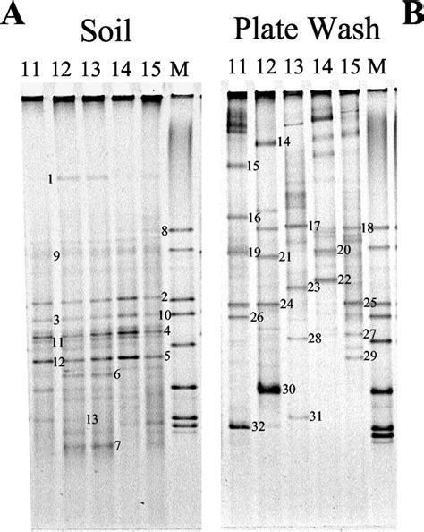 Dgge Gels Showing Diversity Of 16s Rrna Gene Fragments Ampli Fi Ed From Download Scientific