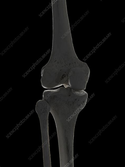 Knee bones, illustration - Stock Image - C055/3062 - Science Photo Library