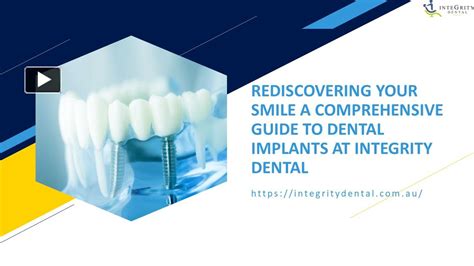 Ppt A Comprehensive Guide To Dental Implants At Integrity Dental