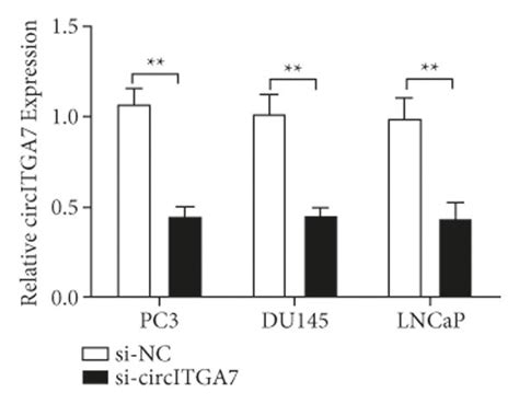 The Knockdown Of Circitga Promotes The Proliferation Of Pca Cells A