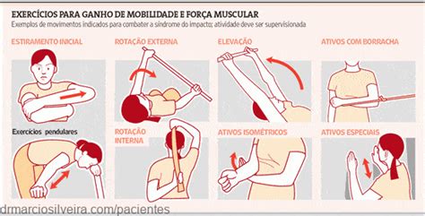 Exercícios para ganho de mobilidade do ombro Pacientes do Dr Márcio