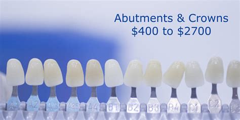 Dental Implant Cost Cost Breakdown Of Dental Implants In Canada