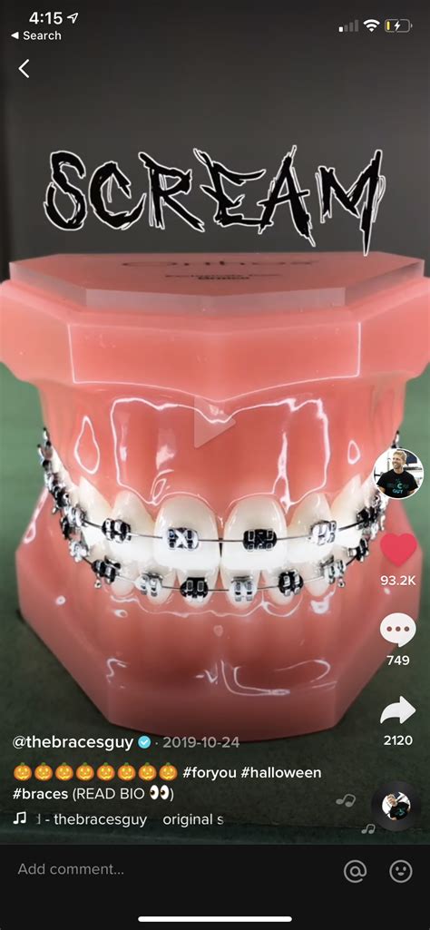 Pin By 𝓩𝓼 𝓹𝓵𝓪𝔂𝓱𝓸𝓾𝓼𝓮 🧚🏽 On Brace Faces Cute Braces Braces Colors