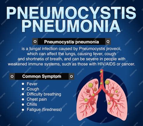 Free Vector Informative Poster Of Pneumocystis Pneumonia