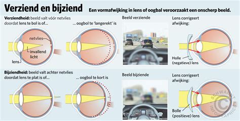 Oogaandoeningen De Lichaamsstelsels