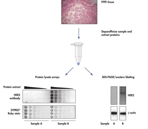 Qproteome Ffpe Tissue Kit Ffpe Protein Extraction Qiagen