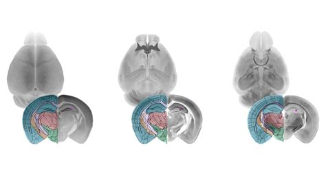 An Optimized Mouse Brain Atlas For Automated Mapping And Quantification