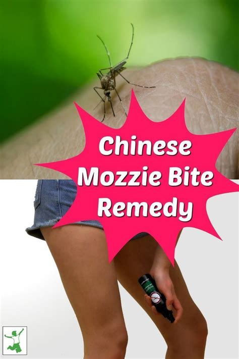 Fast Acting Mosquito Bite Remedy Thats Probably Already In Your