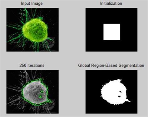 PDF Image Segmentation Using Active Contour Model Semantic Scholar