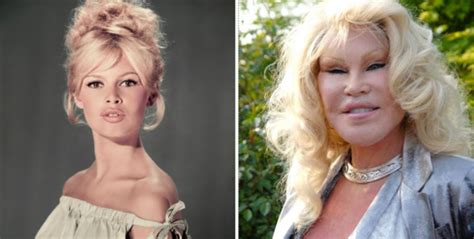 La Mujer Con Cirug A Est Tica Extensa C Mo Era Jocelyn Wildenstein