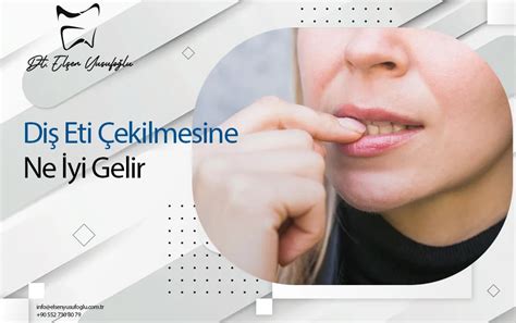 Di Eti Ekilmesine Ne Yi Gelir Nedenleri Ve Belirtileri