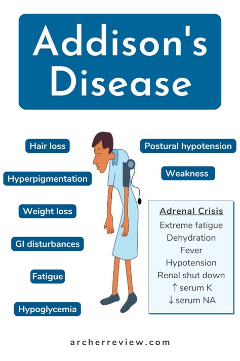 In Addison S Disease The Adrenal Gland Isn T Producing Enough Of Hormones Like Cortisol And