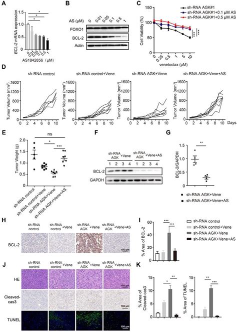 Inhibition Of Acylglycerol Kinase Sensitizes Dlbcl To Venetoclax Via Upregulation Of Foxo1