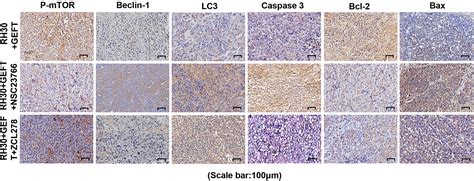 Frontiers Geft Inhibits Autophagy And Apoptosis In Rhabdomyosarcoma