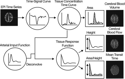 Principles Of T2 Weighted Dynamic Susceptibility Contrast MRI