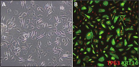 Fully Differentiated IPSC K A Phase Contrast Image Of Day 45 IPSC K