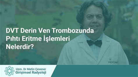 DVT Derin Ven Trombozunda Pıhtı Eritme İşlemleri Nedir YouTube