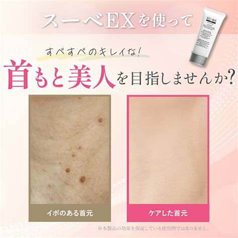 楽天市場初めての方限定 500円OFF 首 イボ 除去 クリーム スーベEX 40g イボ取り 小さなイボ ibo 老人 性 いぼ 薬